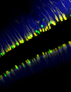 ImageJ=1.54f
unit=micron